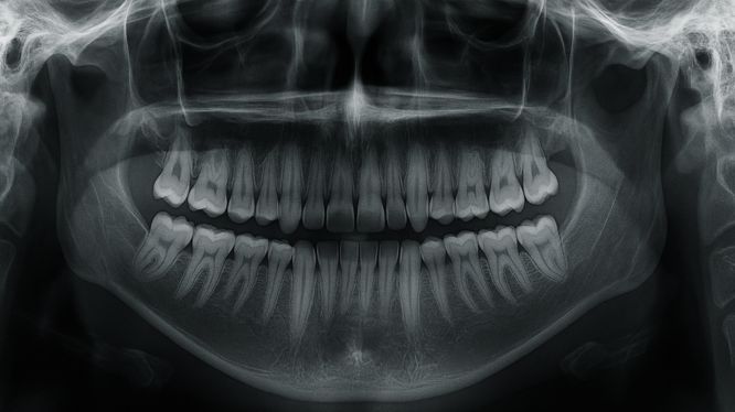 Radiografía panorámica digital del maxilar y mandíbula mostrando ambas arcadas dentales completas, utilizada en diagnósticos odontológicos en Dicorsa.