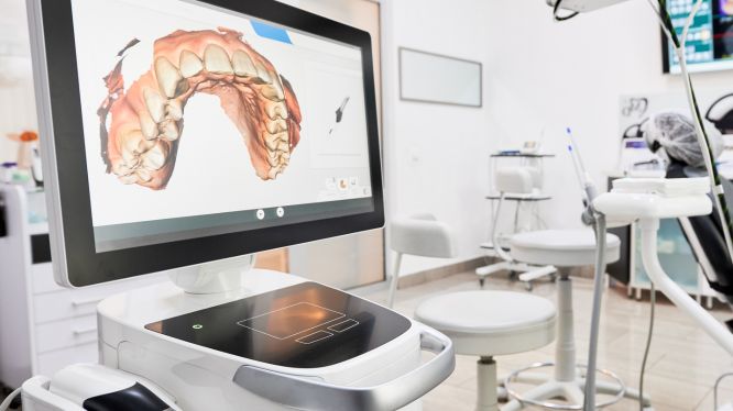 Escáner intraoral iTero