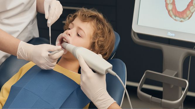 Escáner intraoral iTero