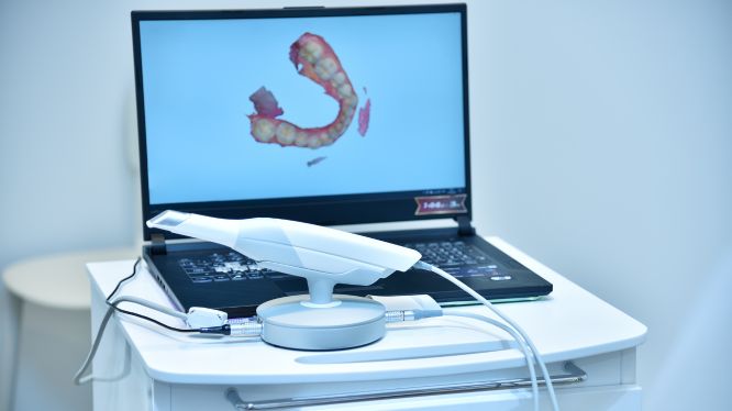 Escáner intraoral iTero