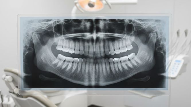 Radiografía panorámica