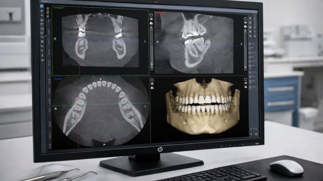 Radiografías dentales en Querétaro para ortodoncia, implantes y cirugía: ¿cuál necesitas según tu tratamiento?
