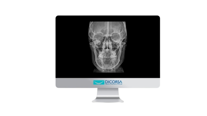 Radiografía anteroposterior en odontología: cuándo se solicita y qué información aporta al diagnóstico