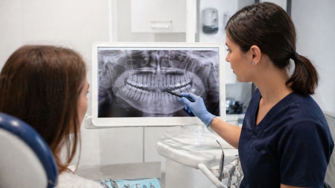 Diagnóstico dental completo: la clave invisible detrás de un tratamiento perfecto