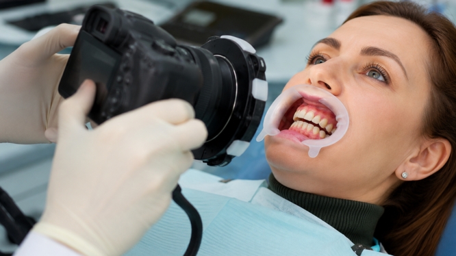 Fotografía intraoral en odontología: cómo mejora el diagnóstico y seguimiento del paciente
