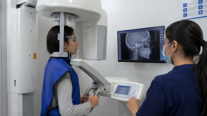 Radiografía lateral de cráneo: por qué es clave en ortodoncia y crecimiento facial