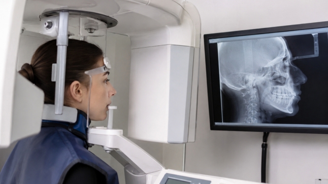 Radiografía lateral de cráneo: por qué es clave en ortodoncia y crecimiento facial