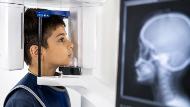 Estudios para ortodoncia en niños: ¿a qué edad conviene realizar el primer diagnóstico completo?