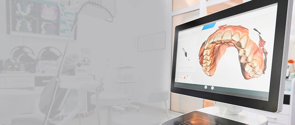 Header Dicorsa Scanner iTero